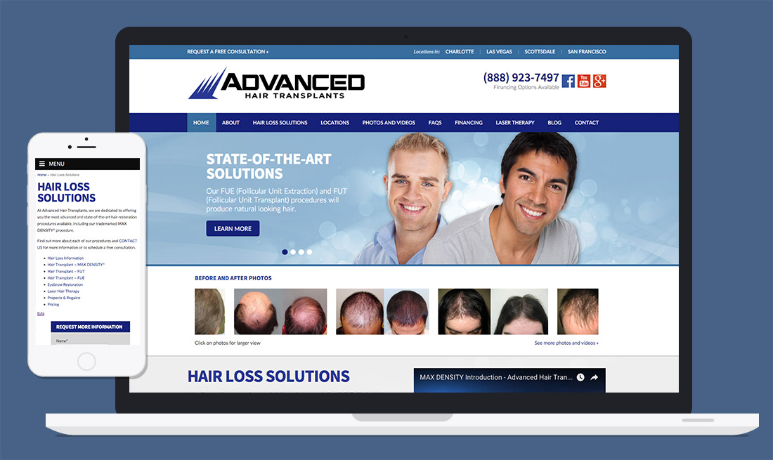 website - Advanced Hair Transplants